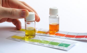 Farbige Wassertests im Glas auf Farbschablonen zur Bestimmung der Wasserwerte im Aquarium