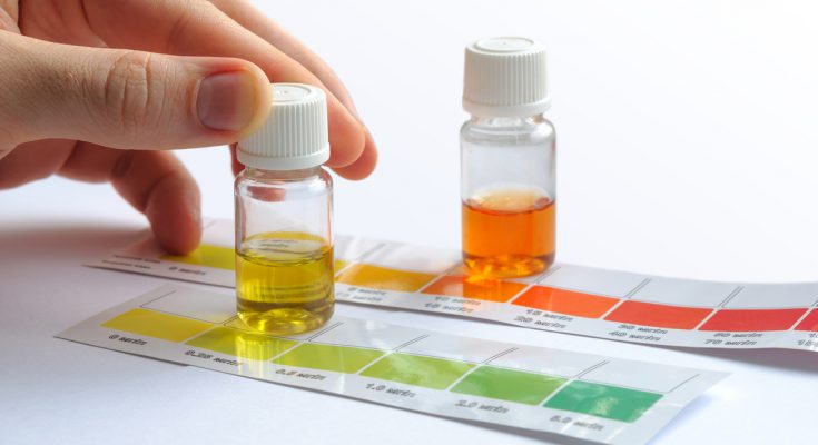 Farbige Wassertests im Glas auf Farbschablonen zur Bestimmung der Wasserwerte im Aquarium